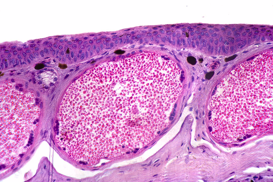 <p>stratified squamous epithelium</p><ul><li><p>many layers of epidermis </p></li></ul><p></p><p></p>