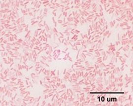 Enterobacter aerogenes