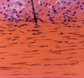 <p>what kind of tissue is this </p>