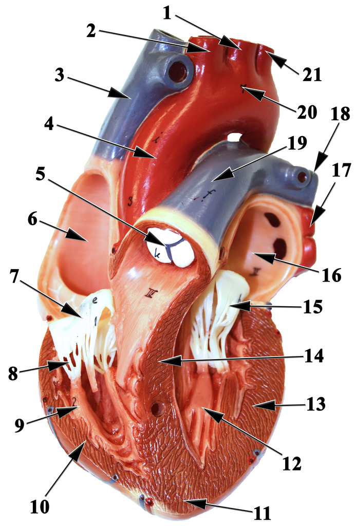 <p><span>Left Pulmonary Artery</span></p>