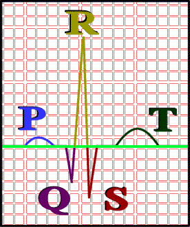 <p>Electrocardiogram (ECG)</p>