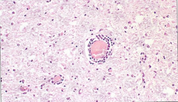 <ol><li><p>Disease</p></li><li><p>Lesion </p></li><li><p>Animal</p></li><li><p>Tissue/Organ</p></li></ol><p></p>