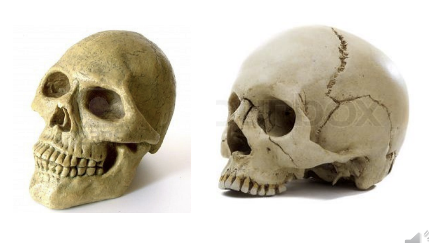 <p>Which is the skull and which is the cranium</p>