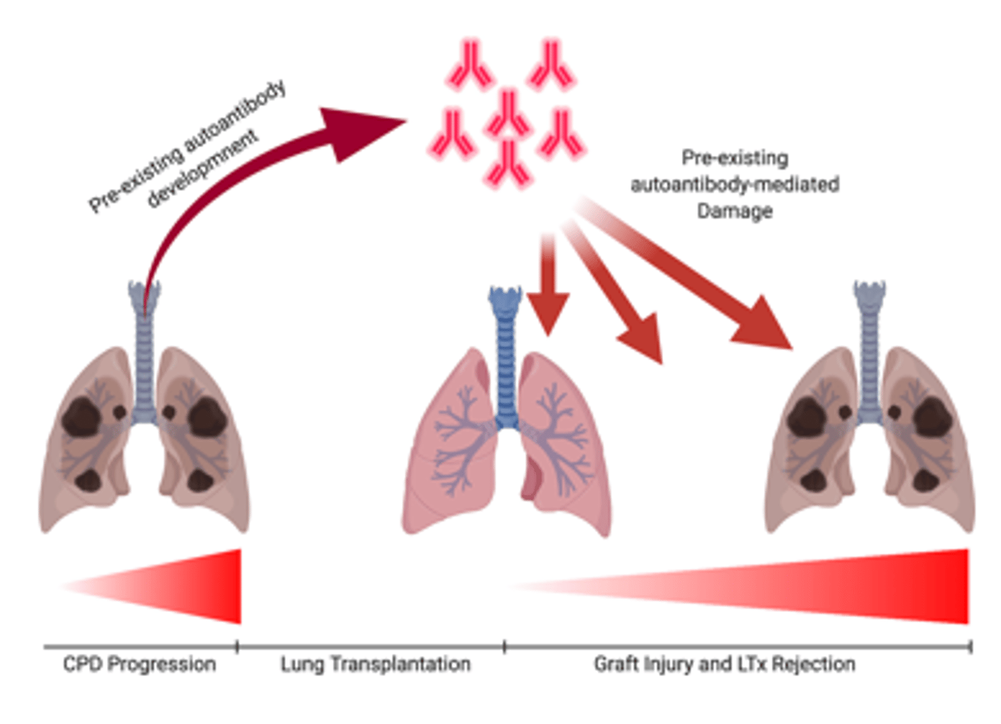 <p>Rejection Symptoms:</p><p>- Fever over ____________________</p><p>- Flu-like symptoms → Chills, aches, headaches, dizziness, ______________________</p><p>- Cough, SOB, _______________________</p><p>- New pain or _______________________ around lung</p>