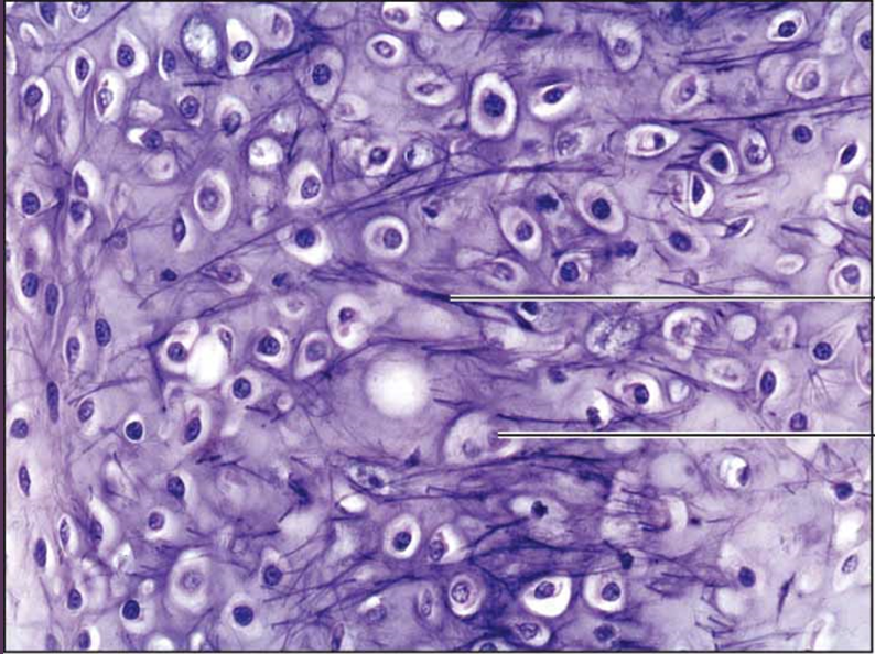 <p>elastic cartilage connective tissue</p>