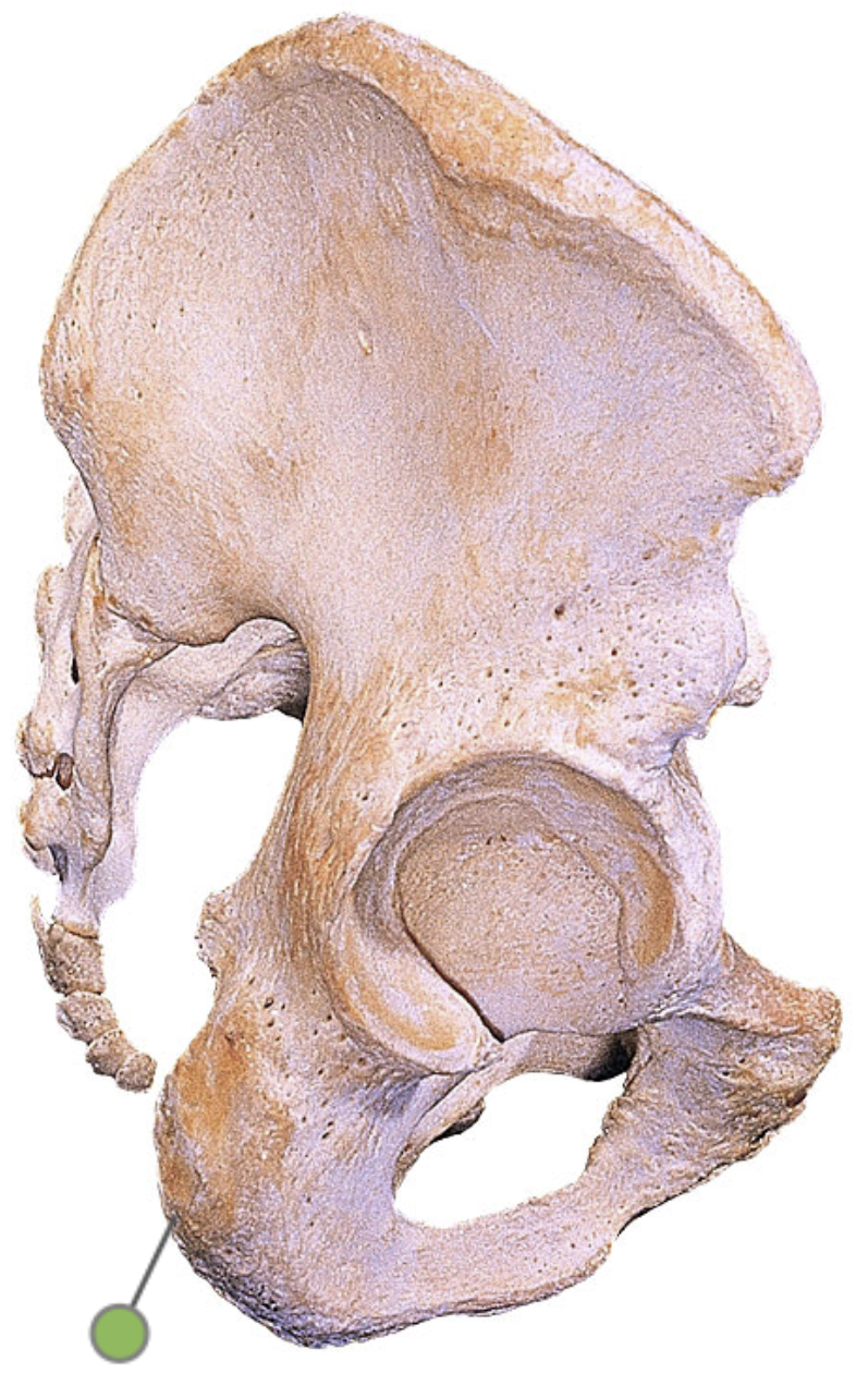 <p>Which bone landmark of the pelvic girdle is a bony prominence located at the bottom of the pelvis, on the posterior aspect of the ischium bone?</p>
