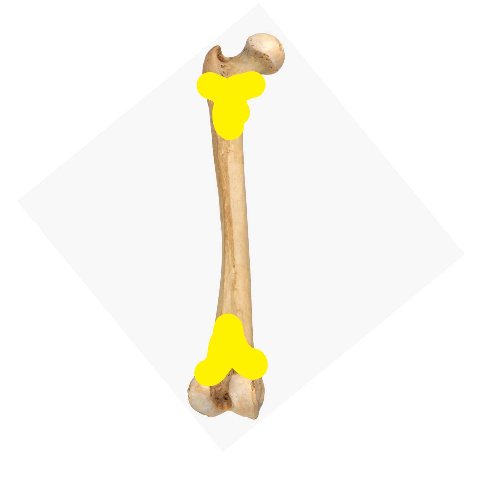 <p>Identify this bone part.</p>