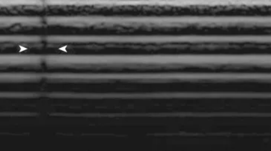 <p>piezoelectric crystals may become damaged or breaks in wiring can occur; displayed as anechoic vertical lines</p>