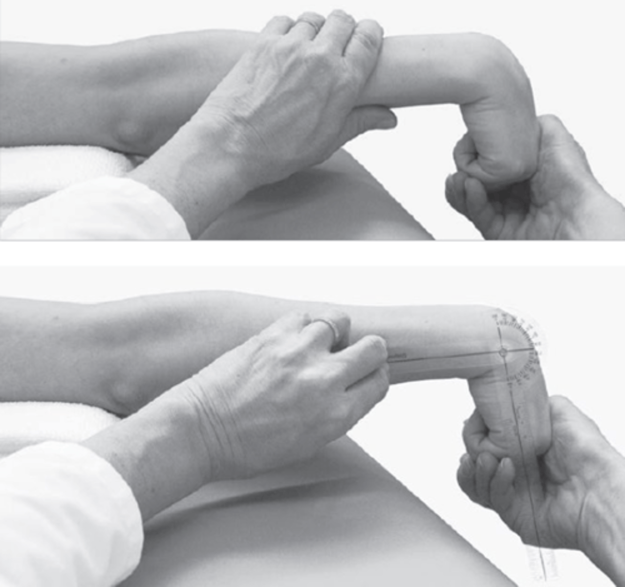 <p>Start position: Sitting next to a supporting surface, elbow in full extension, MCP, PIP, DIP jts in full flexion, forearm pronation, wrist in neutral</p><p>Testing motion: Hold the MCP, PIP, DIP jts in full flexion while flexing the wrist until resistance occurs, and additional wrist flexion causes the fingers to extend or elbow to flex</p><p>Pos/neg: No normative values (about</p><p>10-15 degrees less than</p><p>normal wrist flexion ROM)</p>