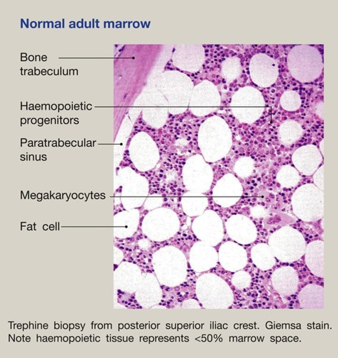 <p>Bone Marrow</p>