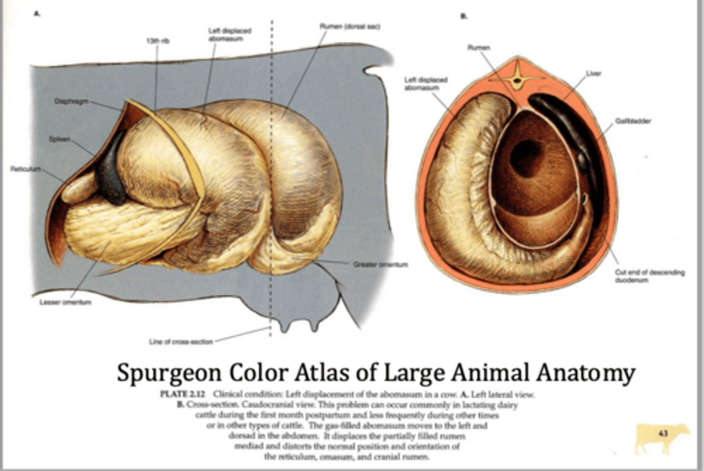 <p>what is the most common abomasal displacement (typically in dairy cattle first few weeks postpartum) but does not usually compromise blood supply</p>