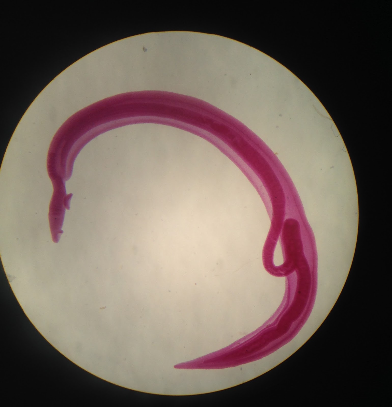 <p><em>Schistosoma mansoni</em></p>