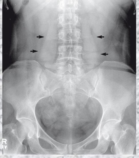 <p>What is seen?</p>