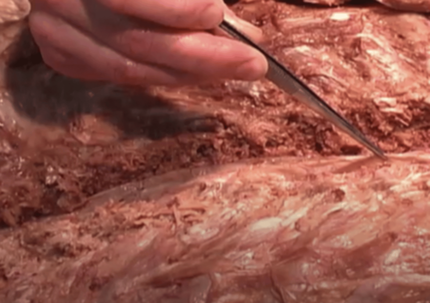 <p>What structure is being shown here?</p><p>lateral vein</p><p>spinus</p><p>dura mater</p><p>abdominus lateralis</p>