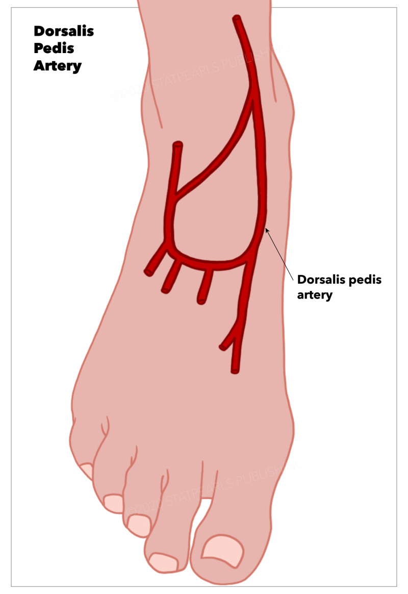 <p><span>pulse palpable on the dorsum of the foot in the first internmetatarsal space just lateral to the extensor tendon of the great toe</span></p>