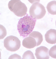 <p>Dr. Vicente Y. Belizario Jr.</p>