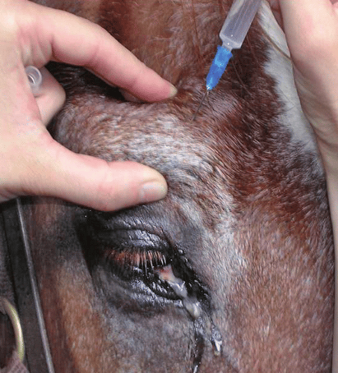 <p>-top of eye</p><p>-supraorbital foramen</p>