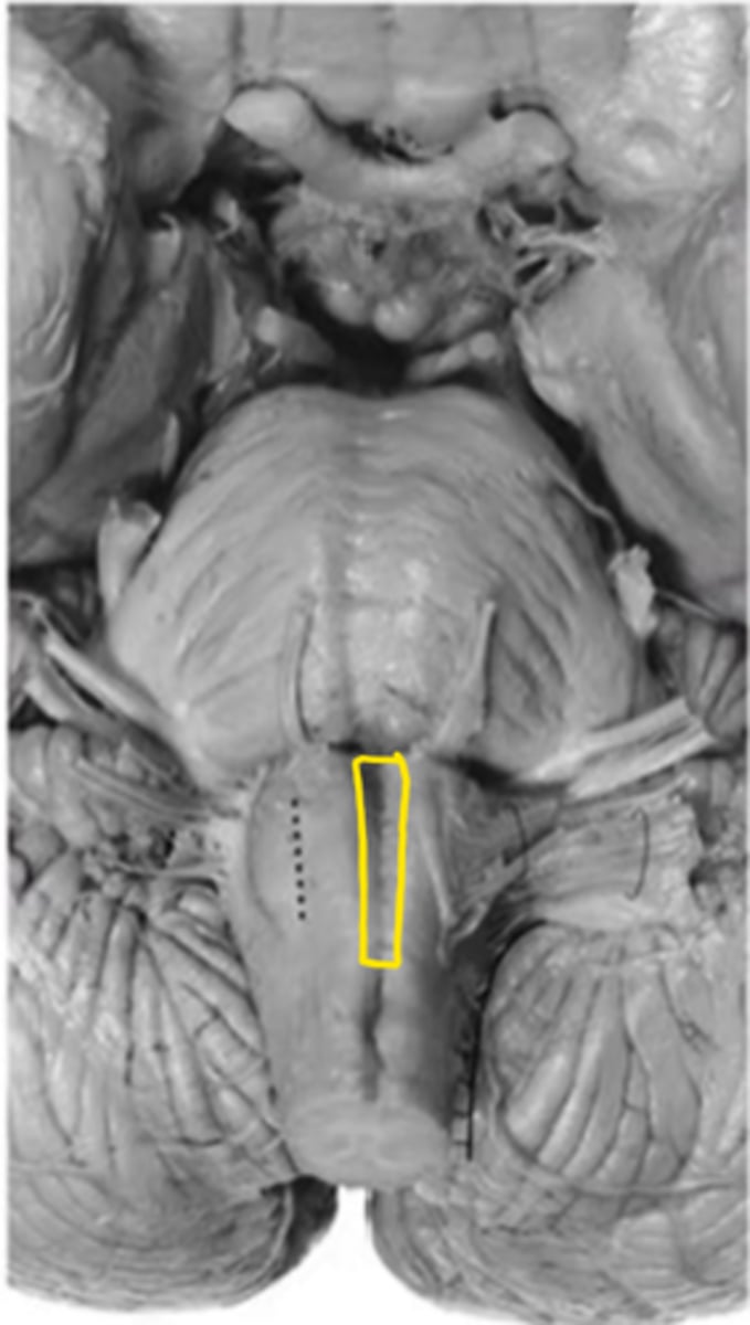 <p>ID the structure</p>