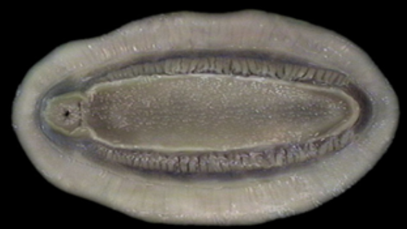 <p>This is the ventral surface of what organism?</p>