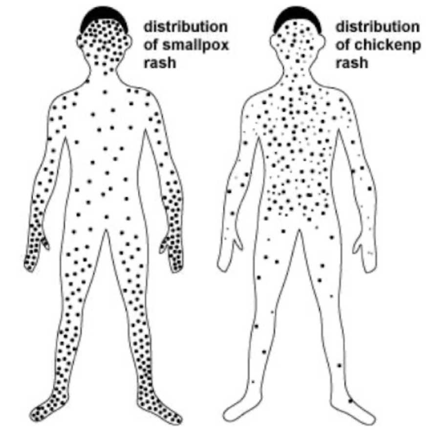 <ul><li><p>Immunity to one agent providing immunity for another related agent</p><ul><li><p>Ex: Cowpox vaccine protects against smallpox</p></li></ul></li></ul><p></p>