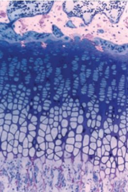 <p>where can this type of bone be found?</p>