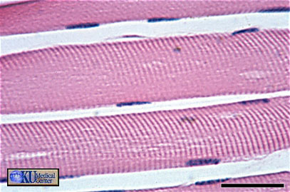 <p>which type of muscle is this?</p>