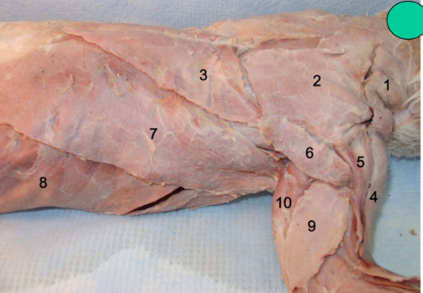 <p>what superficial shoulder (&amp; back) muscle is number 7?</p>