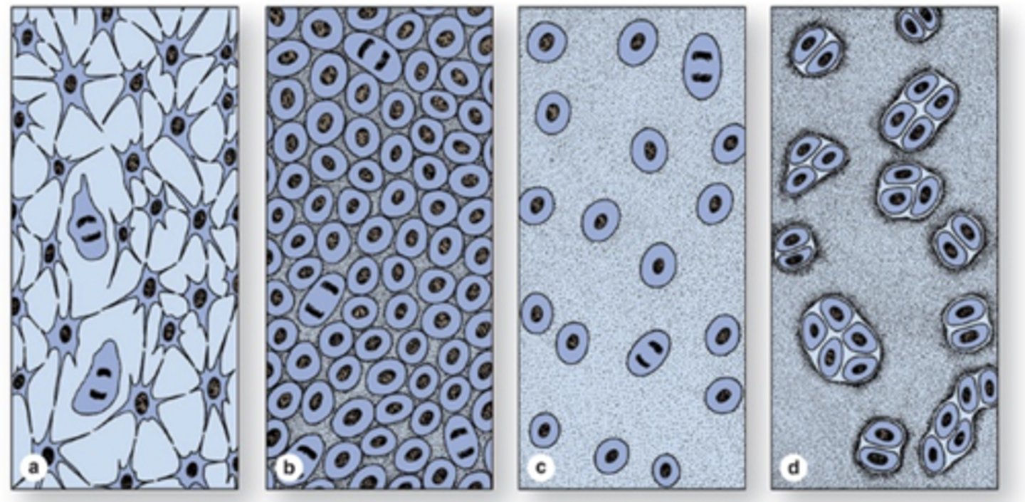 <p>What are the steps of cartilage formation (condrogenesis)? (4)</p>