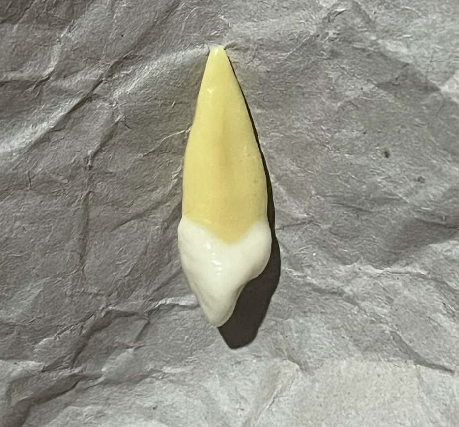 <p>What tooth is this (with view)?</p>