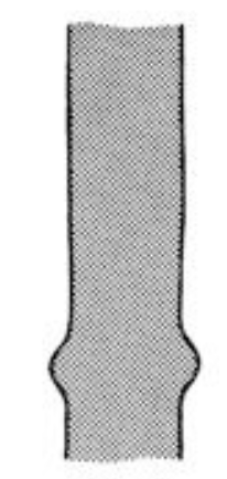 <p>What classification of fracture is this?</p>