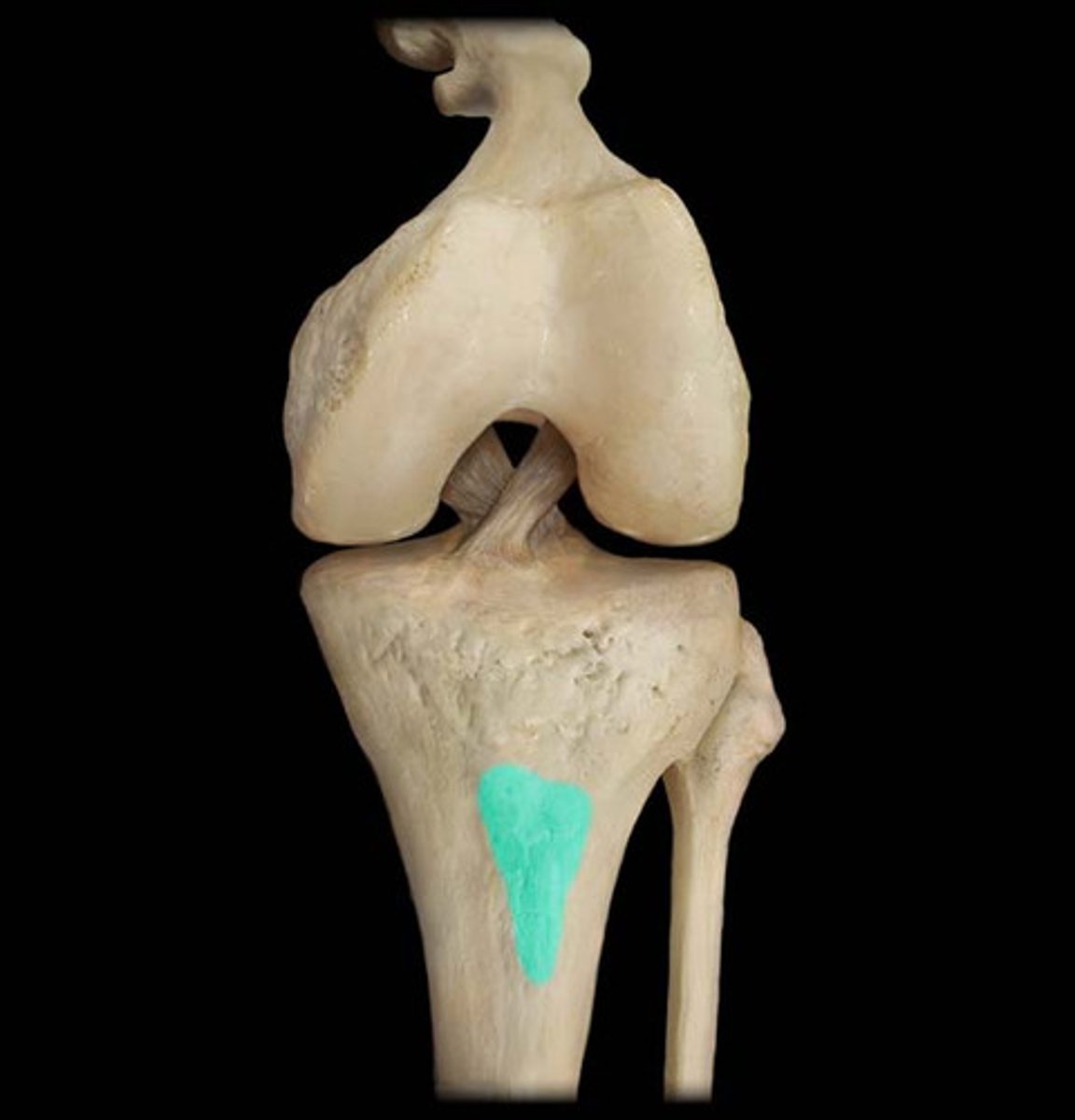 <p>Point where the patellar ligament and quadriceps tendon attaches.</p>