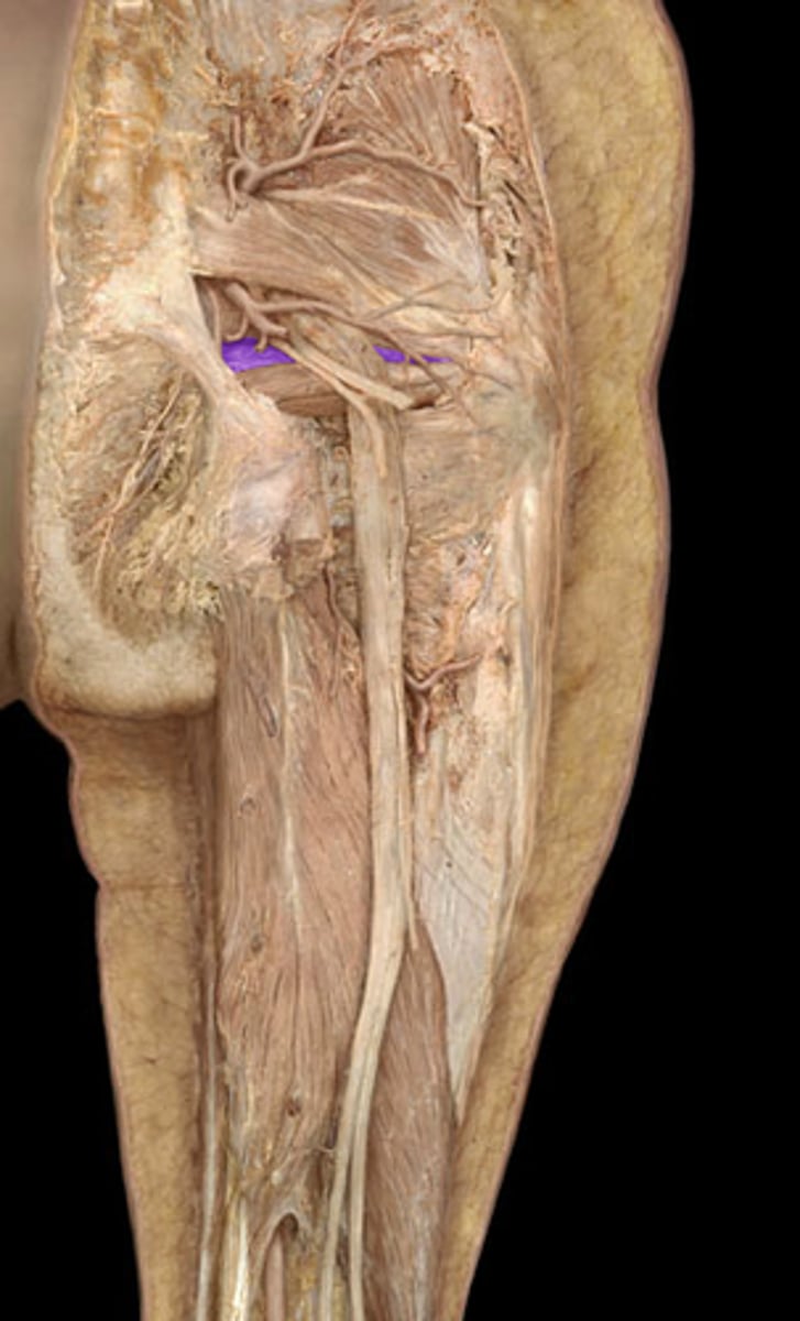 <p>inferior gluteal artery</p>