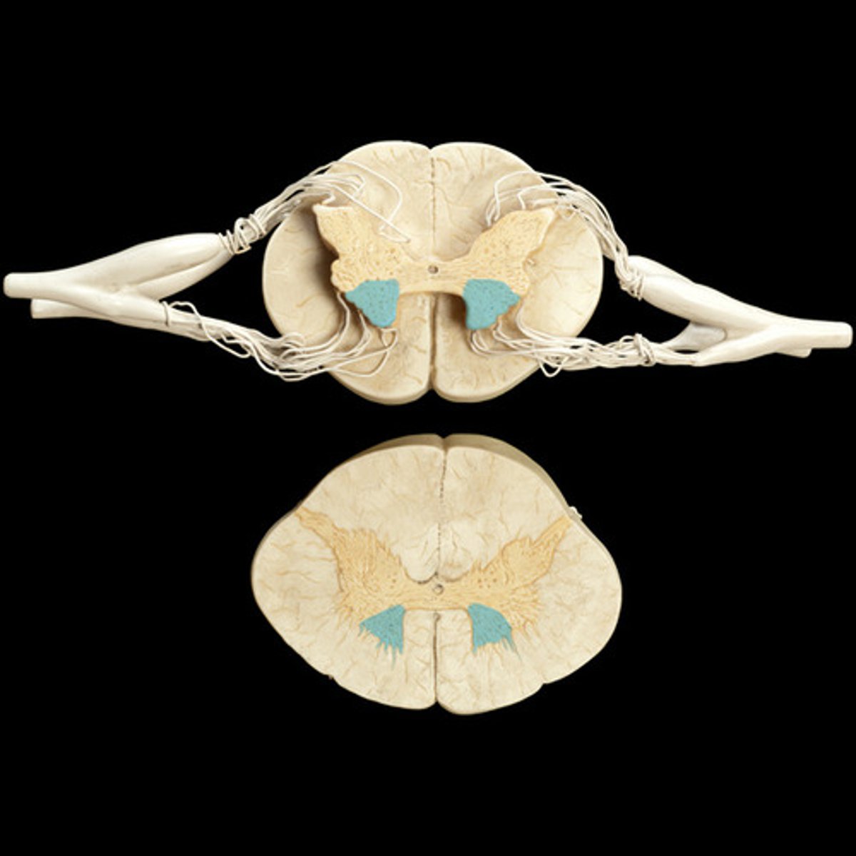 <p>Ventral gray horn</p>