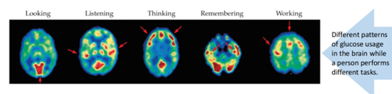 <p>Detects metabolic activity in the brain by using an injected radioactive tracer (e.g. 2-deoxy-D-glucose) </p>