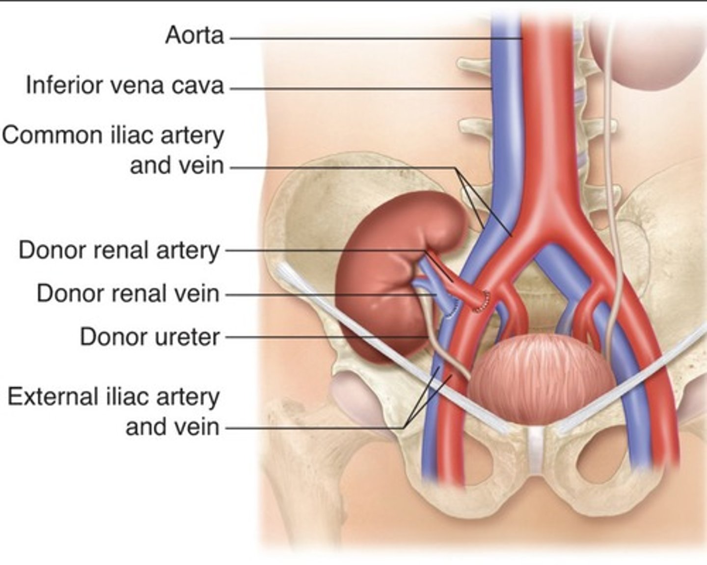 <p>Superficially located</p><p>Runs with the axis of incision</p><p>Hilum oriented inferiorly and posteriorly</p>