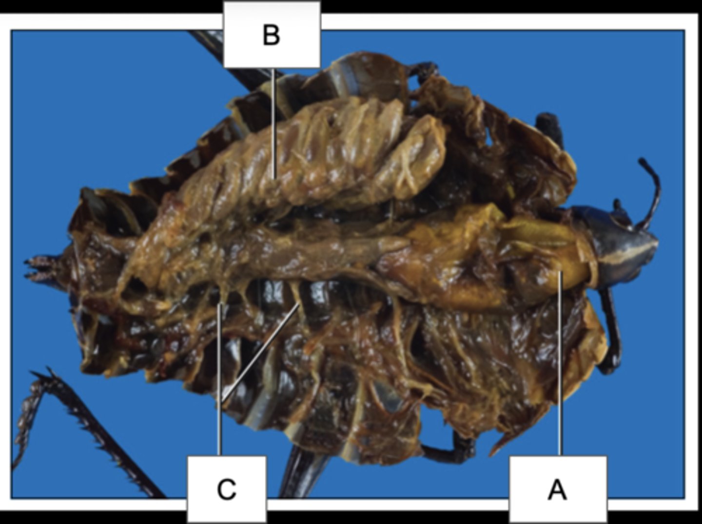 <p>Which structure is labeled A?</p>