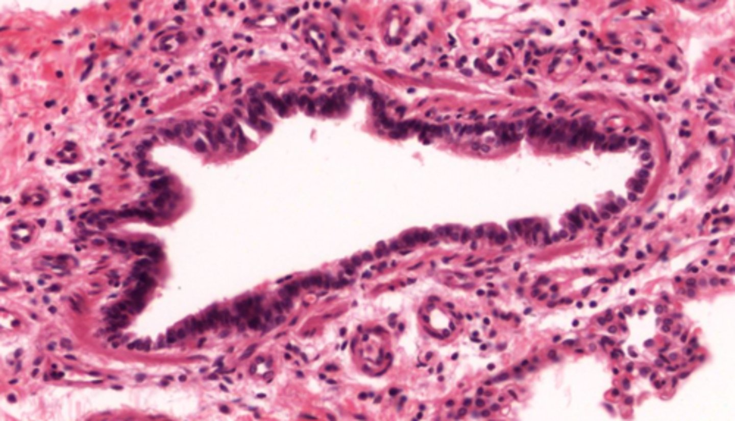 <p>Identify the type of bronchiole</p>