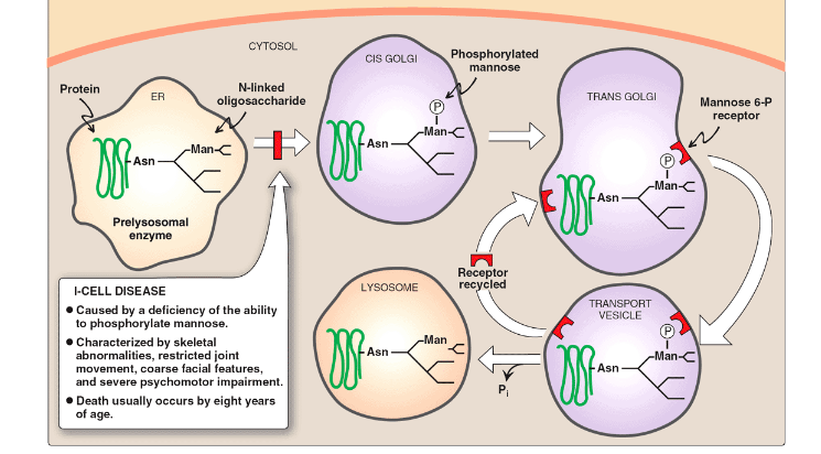<ul><li><p><strong><em><u>Deficient mannose phosphorylation </u></em></strong>on lysosomal enzymes</p></li><li><p>Lysosomal enzymes are not delivered to the lysosomes (instead they are secreted).</p></li><li><p>Macromolecules are not degraded (enlarged lysosomes, Inclusion bodies)</p></li></ul><p></p>