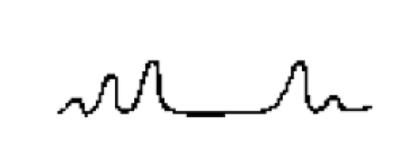 <p>a distinct pattern of breathing characterized by irregular breathing rates and tidal volumes</p>