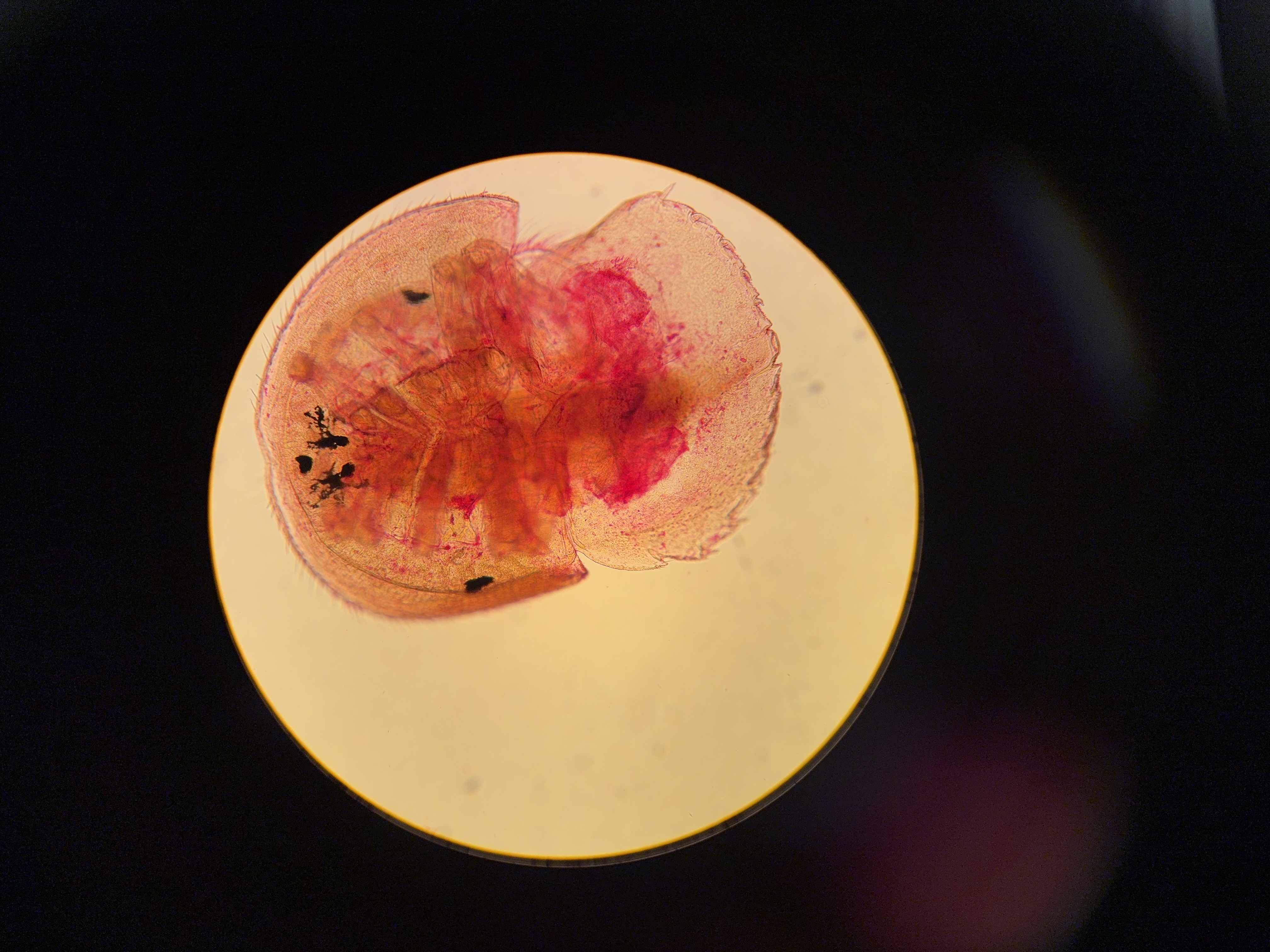 <p>what class does this larvae belong to&nbsp;</p>