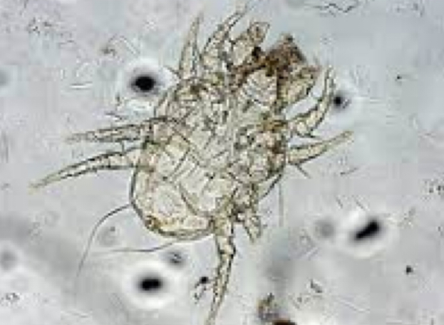 <p>What mite is this and where would you find it?</p>