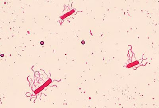 <ul><li><p>visualize flagella</p></li><li><p>mordant applied to increase thickness of flagella</p></li></ul>