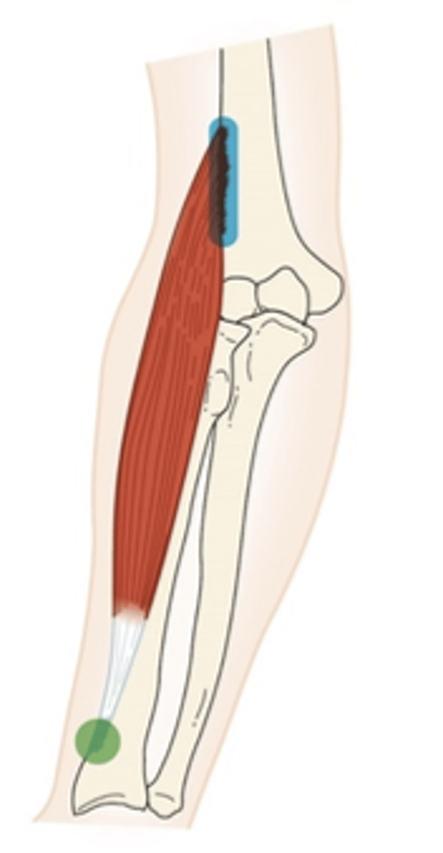 <p>What muscle is this?</p>