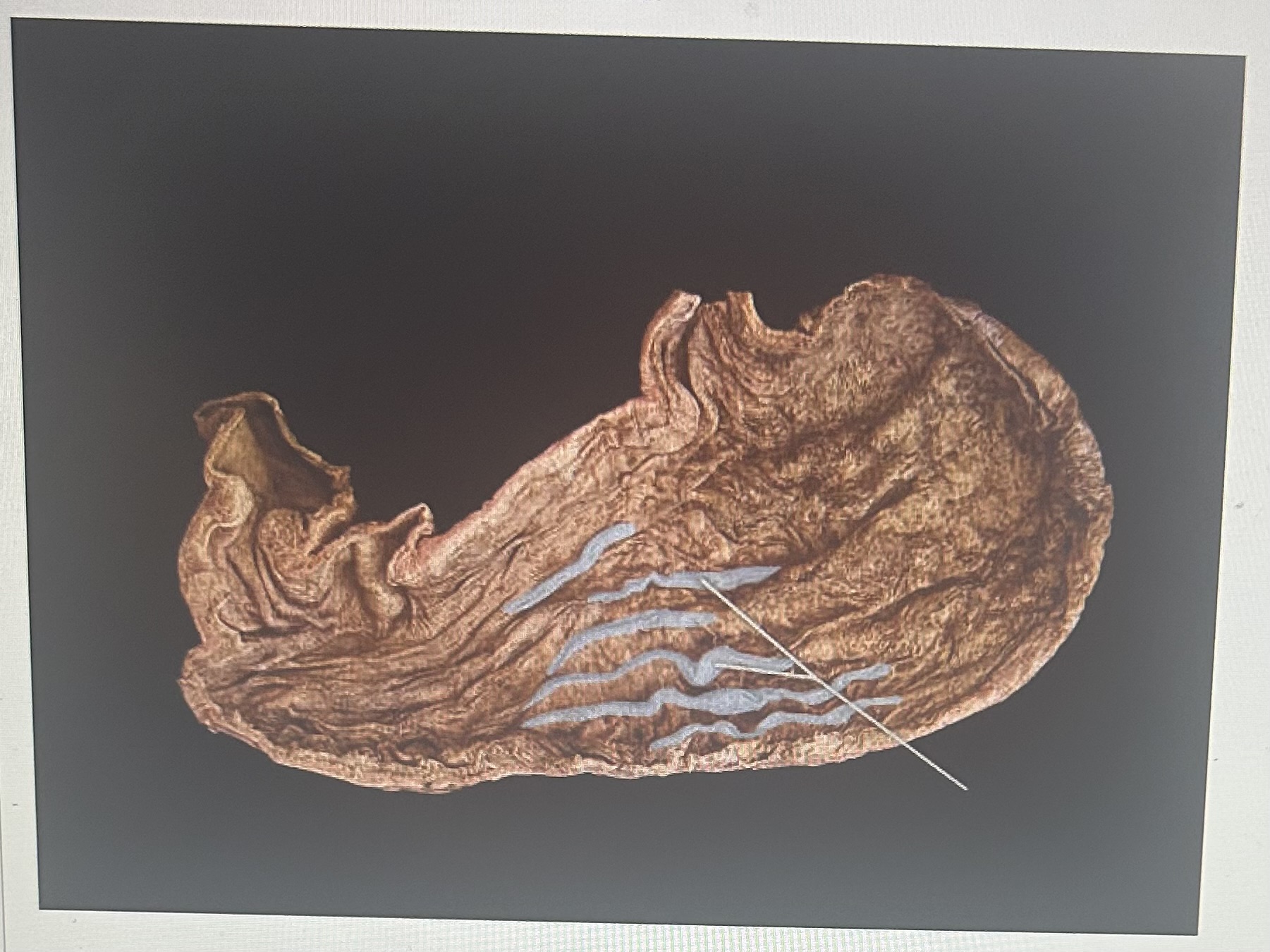 Identify the highlighted digestive system structure 