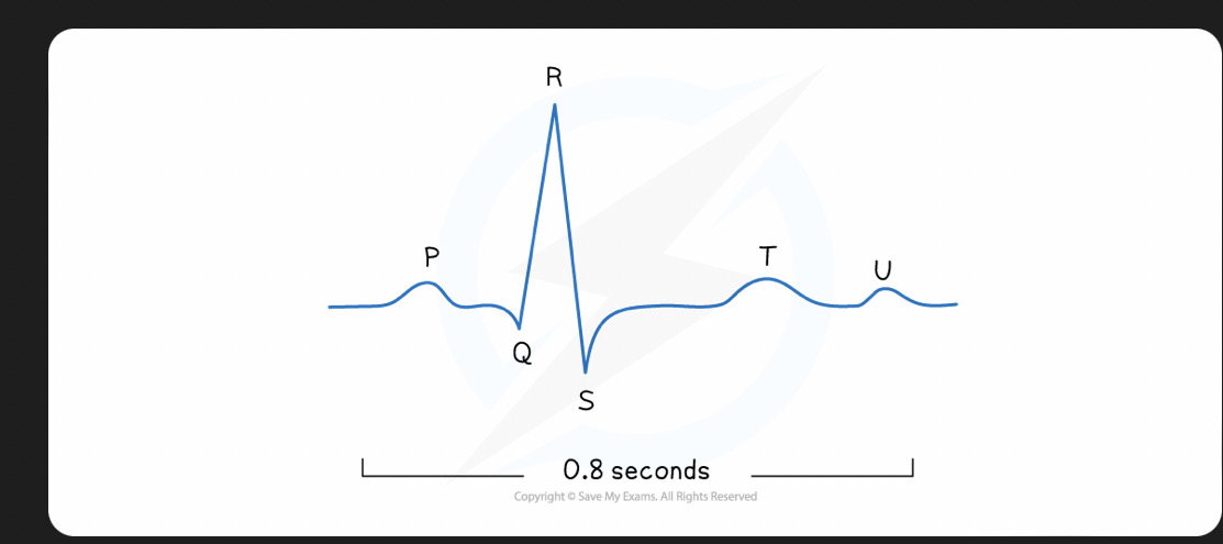 <p>P = Atrial systole QRS = ventricular systole T = diastole U= repolarisation</p>
