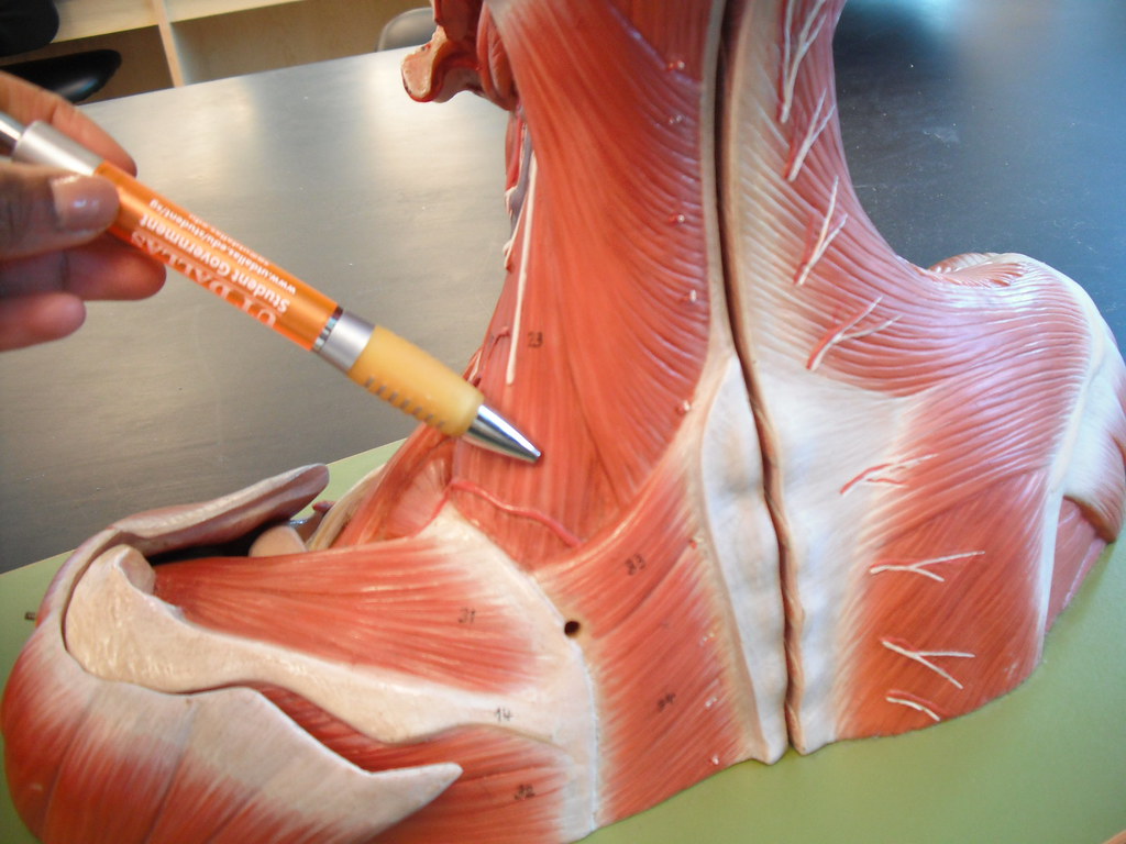 <p>What muscle is this?*****</p>