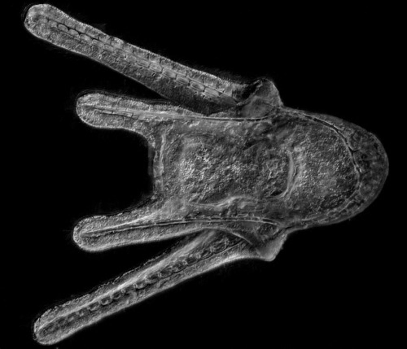 <p>- Endoskeleton already develops at larval stages in some echinoderms (sea urchins)</p><p>- Very similar to those of hemichordates</p><p>- Non-yolky eggs - larvae feed on plankton</p><p>- Both use cilia for locomotion</p><p>- Tripartite coelom: protocoel, mesocoel and metacoel</p>