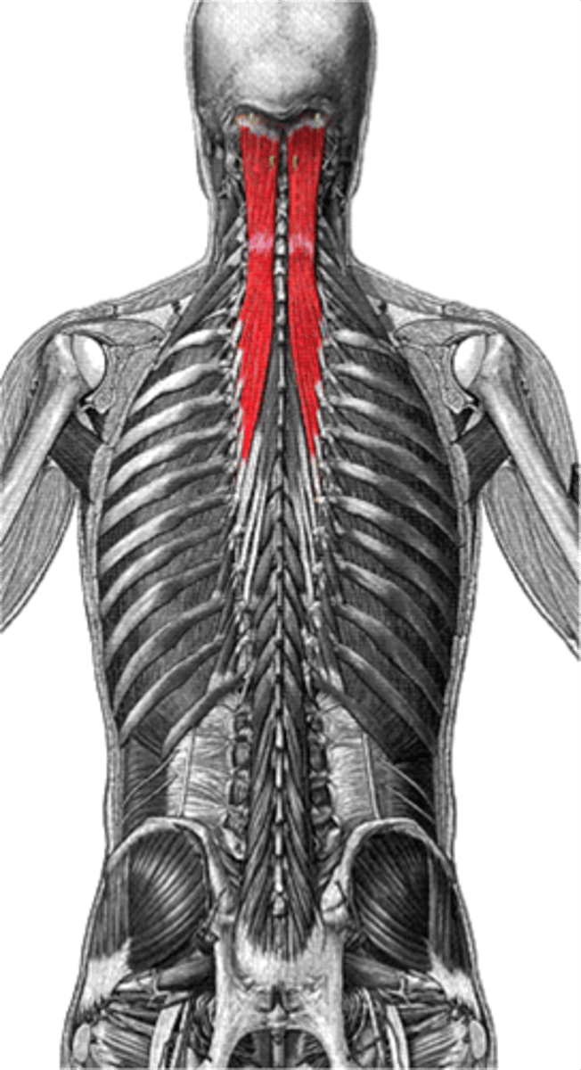 <p>A muscle located in the back of the neck that aids in extending and rotating the head.</p>