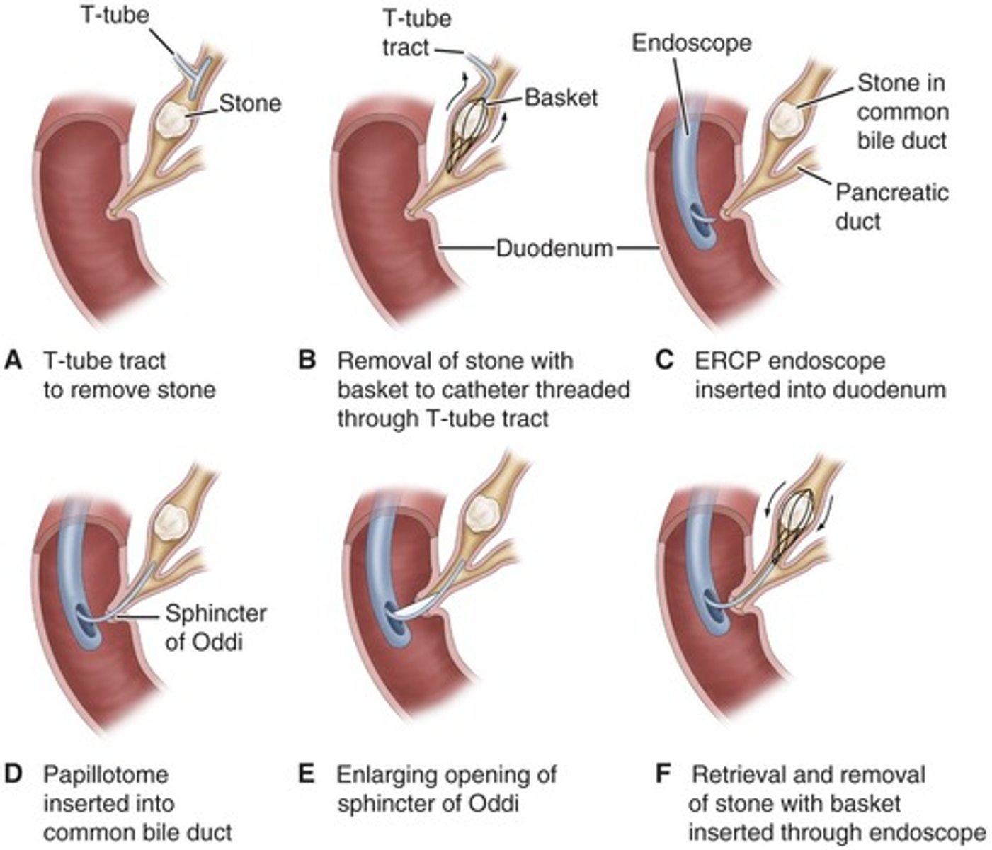 <p>-abdominal x-ray</p><p>-ultrasound</p><p>-ERCP (endoscopic retrograde cholangiopancreatography)</p><p>-Percutaneous Transheptic Cholangiography (PTC) high risk patients more costly</p><p>-Labs</p>