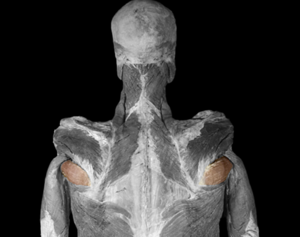 <p>What is this muscle </p>